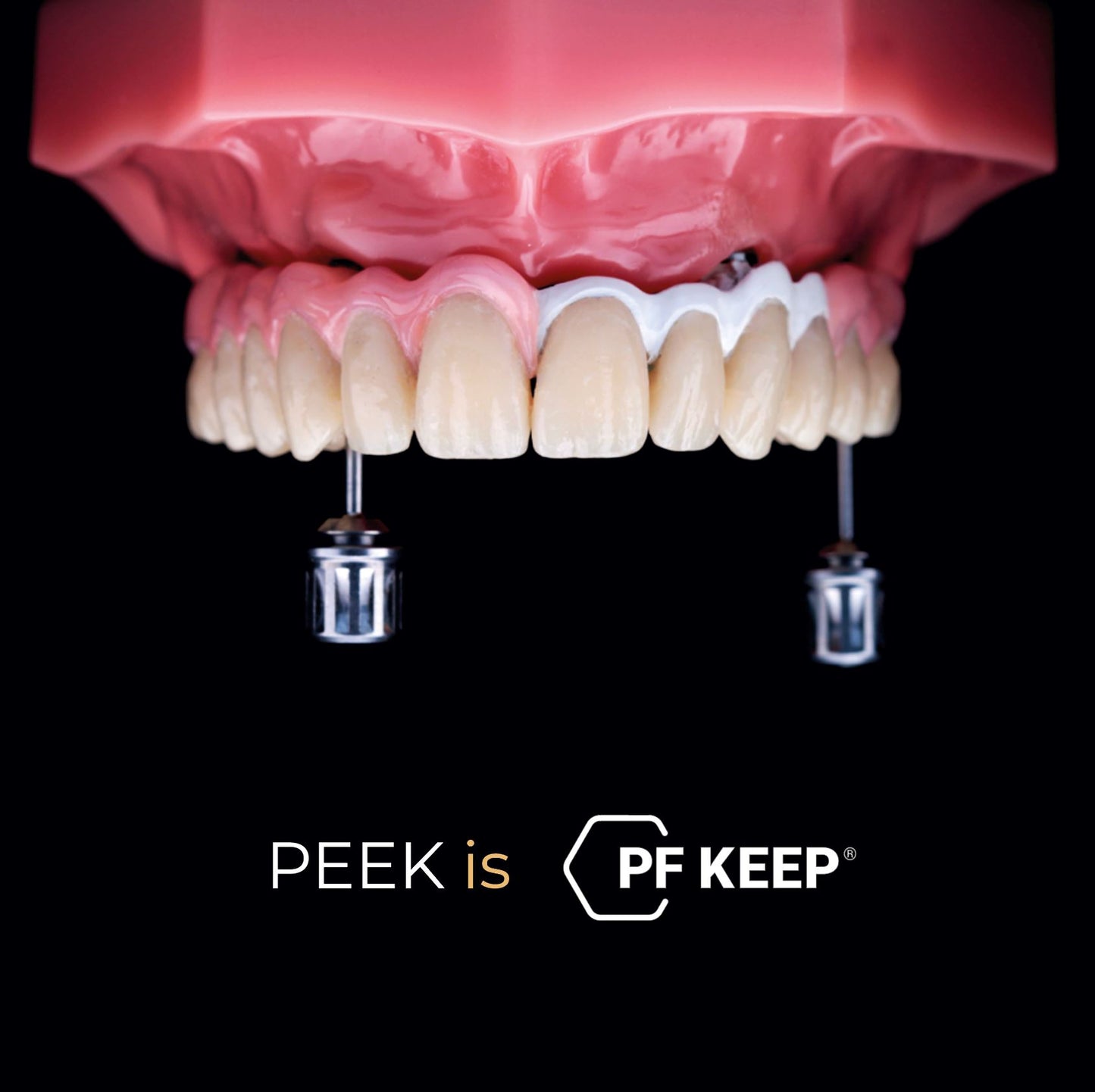Sistema de prensado Peek - PF KEEP® más curso GRATIS de 4 días - Implantes y barras de peek Dental CLEMDE Dental
