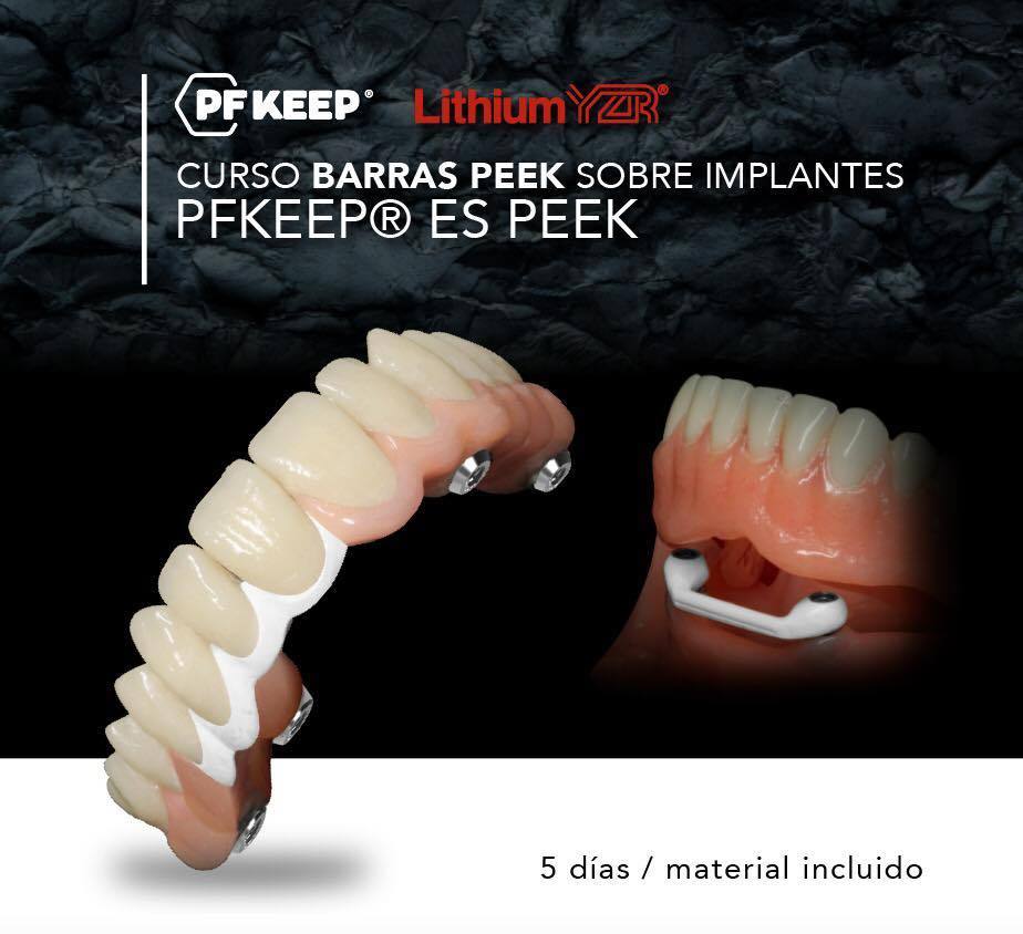 Sistema de prensado Peek - PF Keep más curso GRATIS de 5 días - Implantes y barras de peek. Dental CLEMDE Dental 