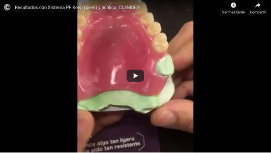 Resultados Sistema PF KEEP (peek)