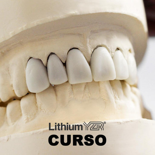 Curso Carillas Lithium YZR® disilicato de litio Dental Lithium YZR 