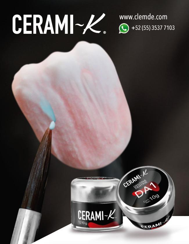 Curso Cerami-K® Metal Porcelana CLEMDE Dental 