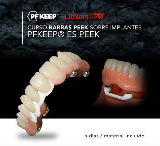 Curso internacional PFKEEP® barras e implantes Dental PF Keep 